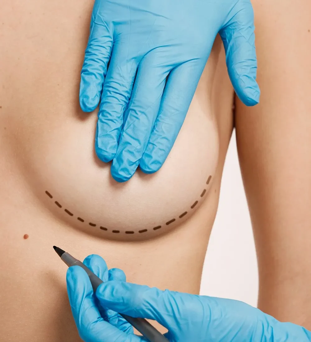 OSAGKXPA6JCYHP6FA7A47GZWNY_resultado